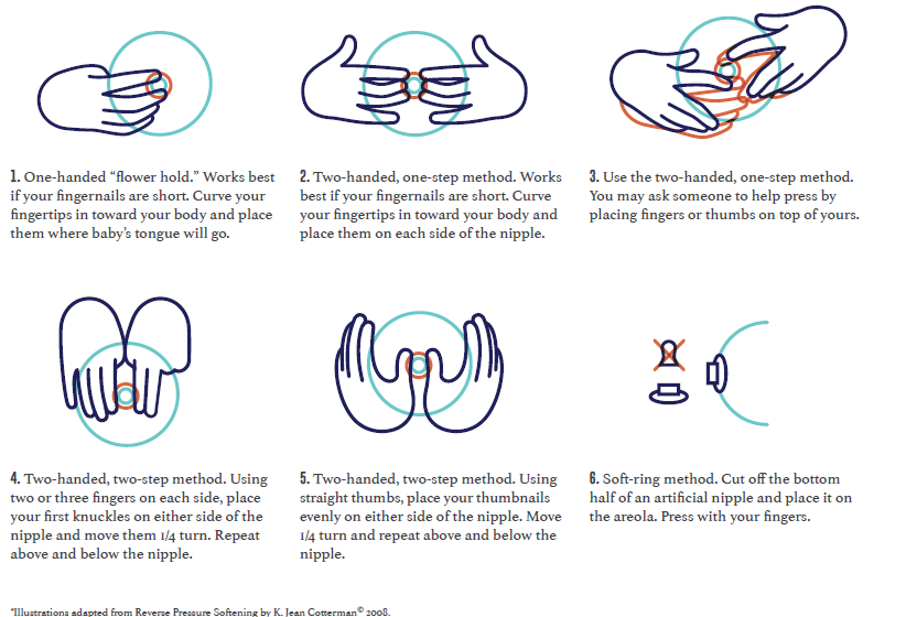 Illustration and explanation of six nipple holds for reverse pressure softening.